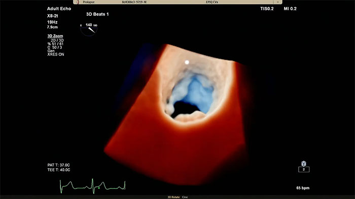 Clinical image of a scan